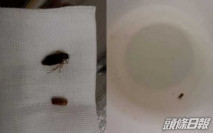 廣東男子半夜耳朵痕癢 驚現蟑螂在內產卵並孵化