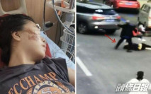 遭前男友駕車輾壓 女子指這只是分手後冰山一角