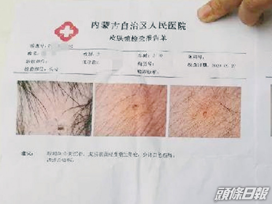 鼎奇昭君幼兒園針扎幼童事件,引發關注。