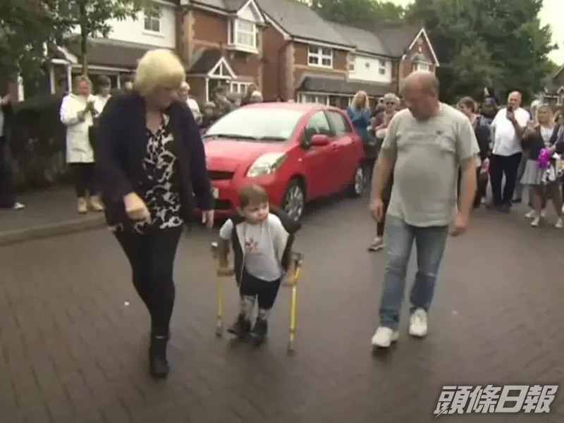 英國一名雙腿截肢的5歲童撐拐杖行6英里,為醫院籌逾千二萬元。(網圖)