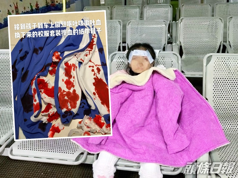 廣州老師疑涉嫌體罰致學生吐血,涉事教師已遭停職。網圖