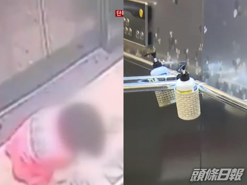 南韓五歲女用消毒搓手液意外射入眼睛。網上圖片