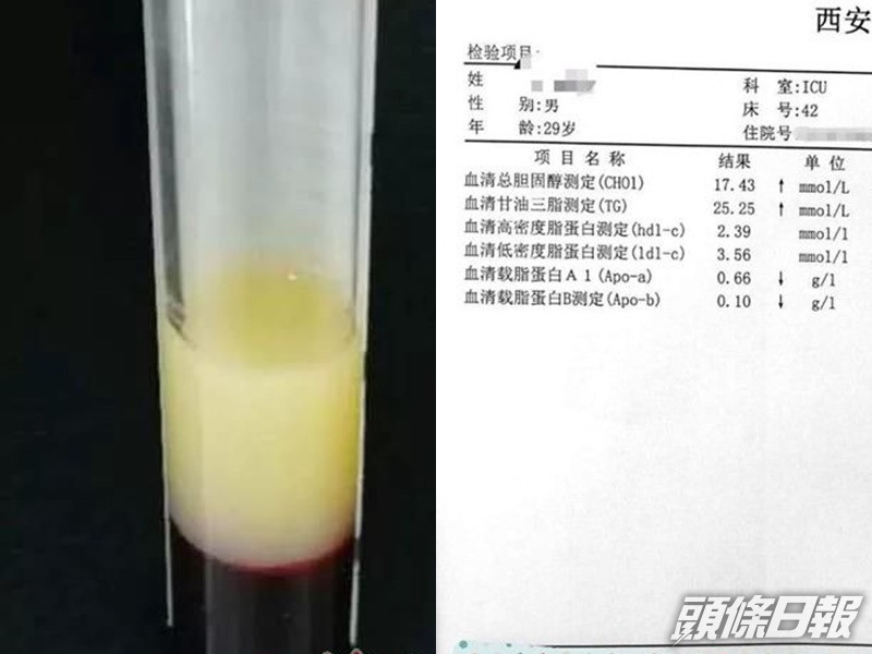男子血液呈奶白色。網圖