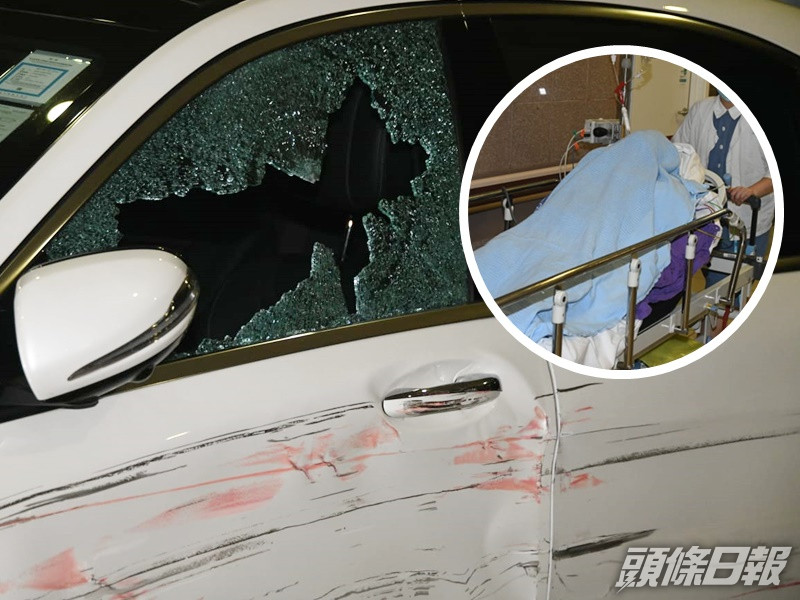 男子遇伏擊心口中槍,警列企圖謀殺。