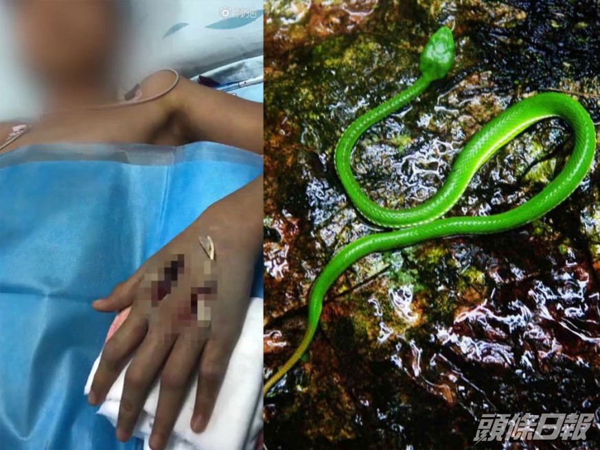 13歲男生網購竹葉青蛇當寵物被咬險送命。