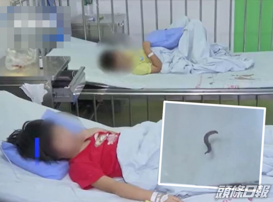 在該對姐弟的尿液中出現黑色幼蟲。網圖