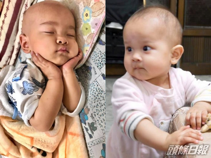台歲半B女因肝腫瘤引發蜂窩性組織炎,經歷10次化療1次手術,終戰性病魔康復。(網圖)