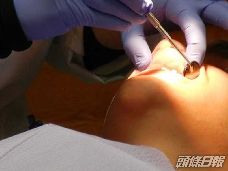 男子剝智慧齒致流血不止。網圖