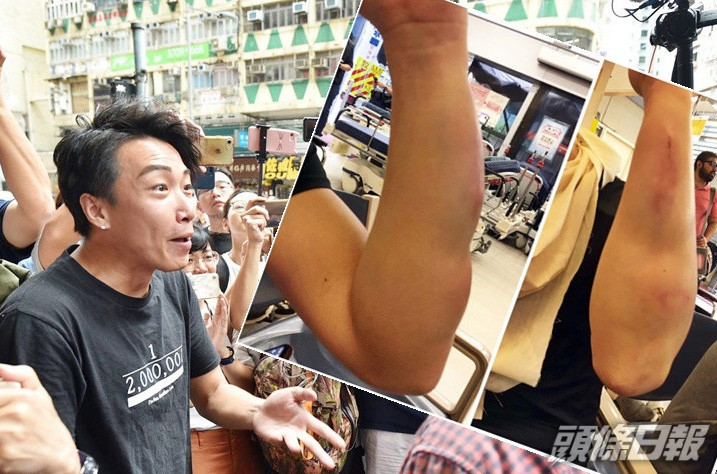 岑子杰去年8月底與友人在餐廳用膳時遭人伏擊。資料圖片