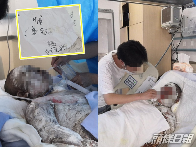 店主夫婦被燒致重傷。網圖