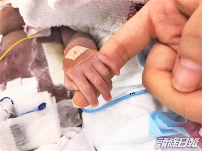 「小秋彥」目前仍在瑪麗醫院接受深切治療。網圖