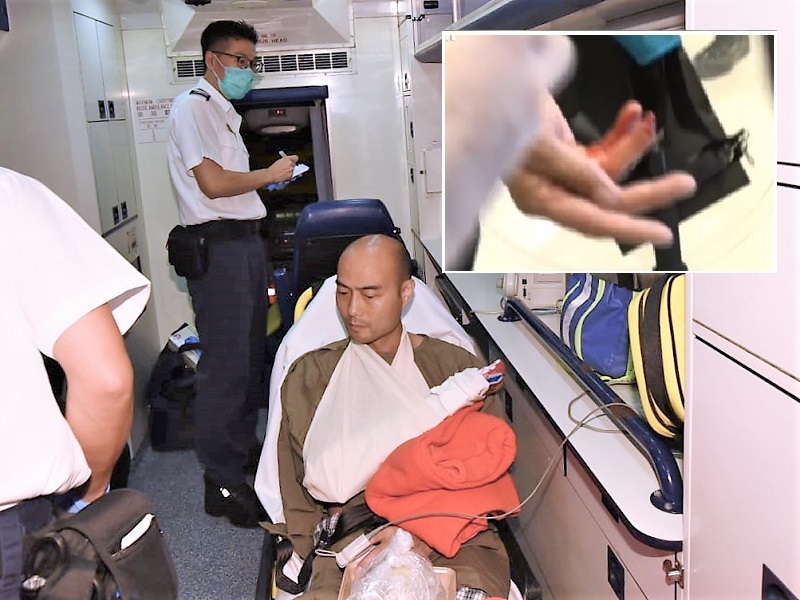 被咬斷手指警員,轉往威院。