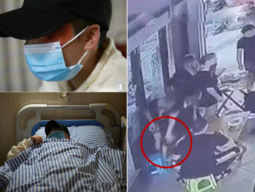 女子拒陌生男子摟抱被打成腦震盪。(網圖)