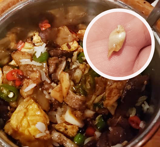 事主指木桶飯驚見「牙齒」。 中伏飲食報料區FB網民Cherie Lo圖