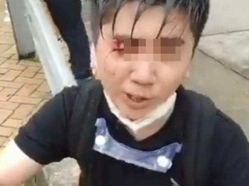 其中一名拔萃女書院男教師中槍致右眼受傷,據悉他已經被捕。網圖