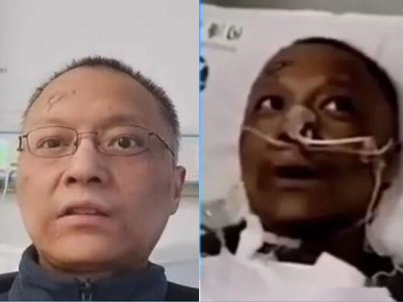 武漢兩名感染新冠肺炎的醫生面容變黑,引發關注,其中一名醫生康復不少更接受採訪,皮革顏色明顯改善。(網圖)