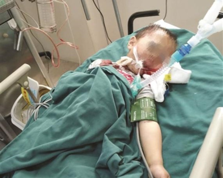 男童送院搶救無效死亡。網圖