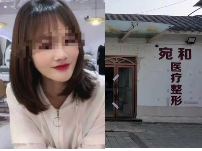 女子整形失敗死亡,驗屍檢報告顯示死因為脂肪栓塞、急性呼吸衰竭。(網圖)