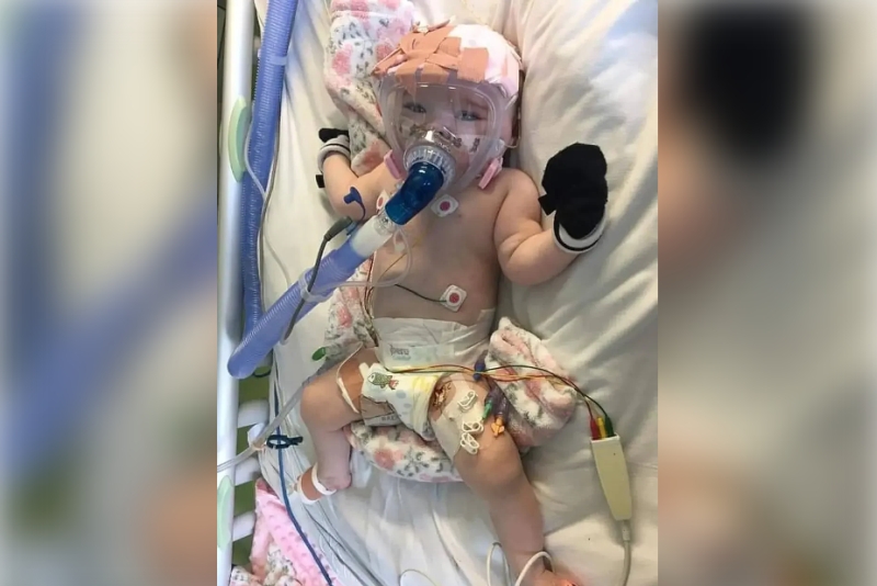 英國6個月大女嬰因心臟和氣管問題需要進行大手術,後來更感染新冠肺炎,但這名生命小鬥士,生命力頑強,成功撃退病毒。(FB圖)