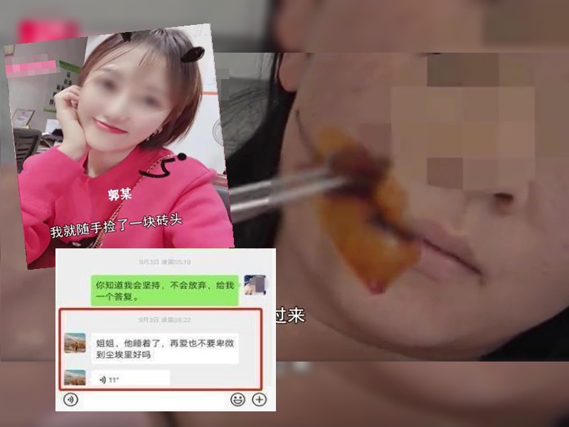 小娟(大圖)被小三(小圖)斬傷半邊臉。網圖