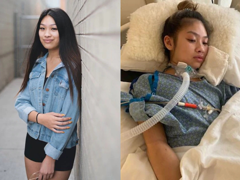 18歲的艾瑪琳接受隆胸手術麻醉期間,被單獨留在手術台上,導致缺氧性腦損傷慘變植物人。(網圖)