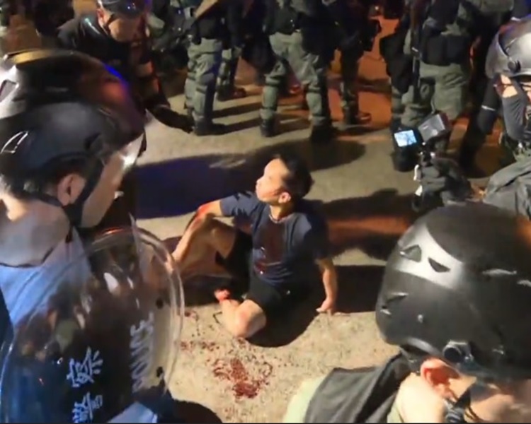 男子當晚被打至頭破血流坐在地上。資料圖片`