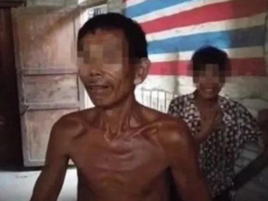 廣西三孩之父鎖妻家中逾十年兼弒母,殘疾人聯合會鑒定,夫妻二人均為精神貳級殘疾。(網圖)