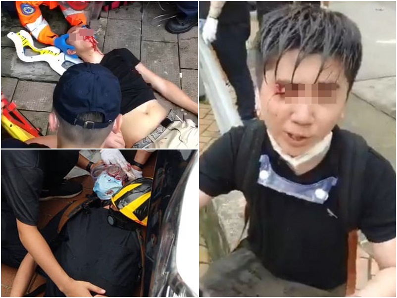 傷者增至72人。