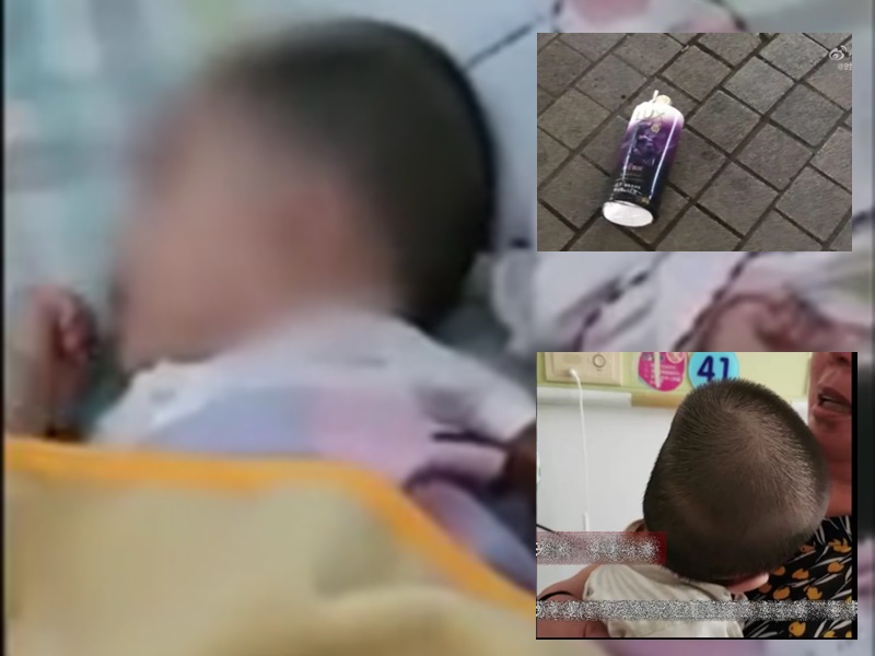6個月大女嬰遭樓上洗頭水砸中,頭骨骨折未脫離危險期。影片截圖