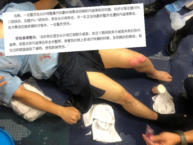 受傷警員稱在長沙灣驅散示威者時,汽油彈無擊中警察。圖為尖沙嘴警署警員受傷圖片